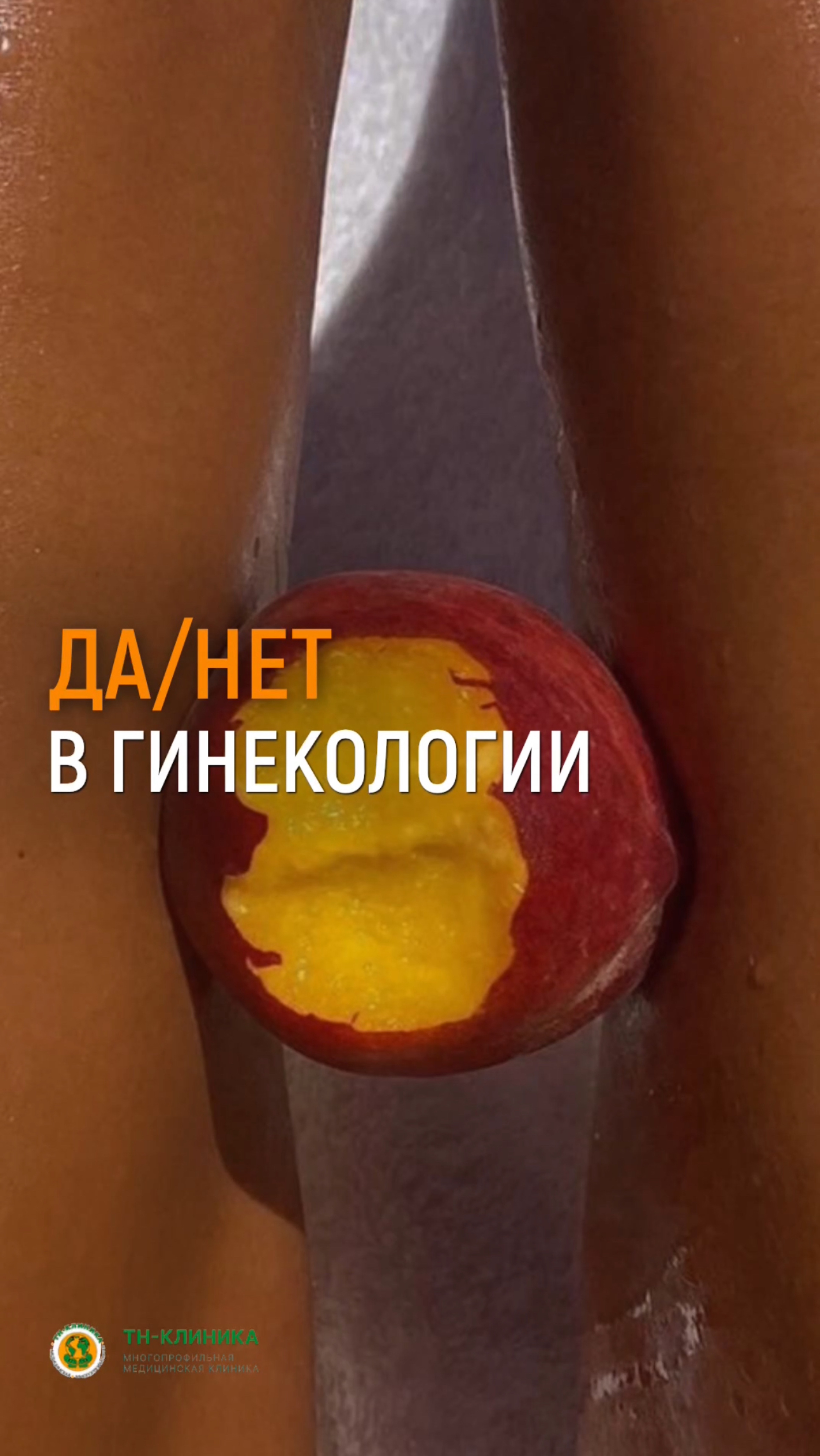 Да или нет в гинекологии