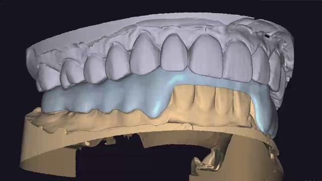 Сплинт-динамика