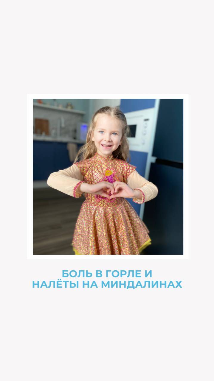 Стрептококковый тонзиллофарингит