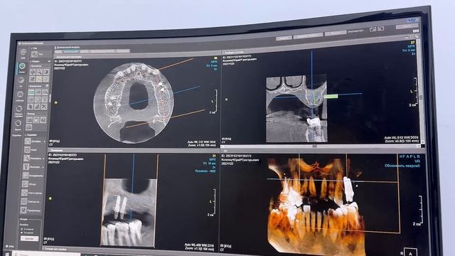 Прогуляемся по MBSmile вместе?😏