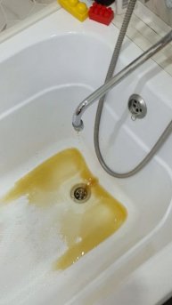 удаление накипи.