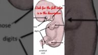 Changes in the second month of Embryonic Period #shorts #Anatomy #mbbs #education