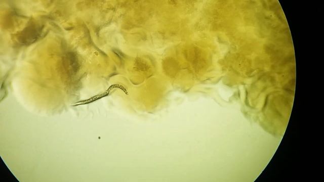 The Journey of Human Parasite  | Strongyloides stercoralis on agar plate Microscopy