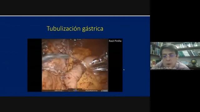 Cáncer de Esófago: Del diagnóstico al tratamiento - #CirugíaUNclick