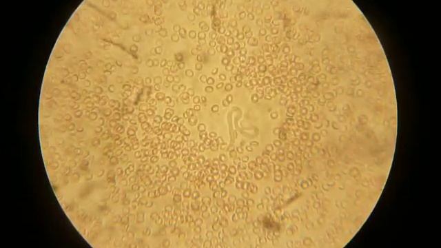 microfilaria de dirofilaria immitis