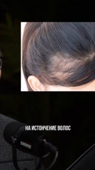 Выпадают волосы? Гинеколог может помочь! #алопеция #эндокринолог #гинеколог