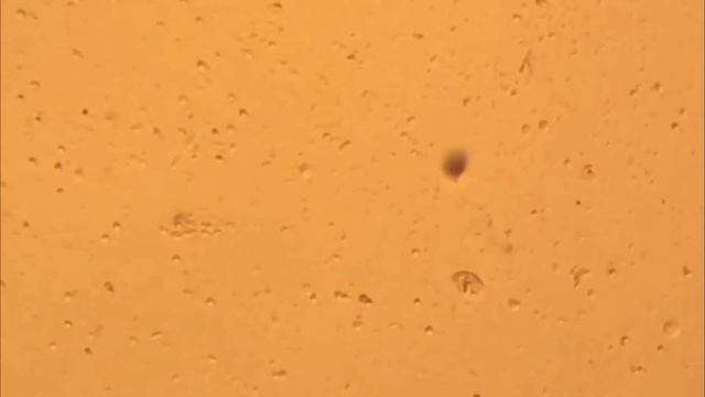 Ancistrumina limnica in mantle cavity of Dreissena polymorpha