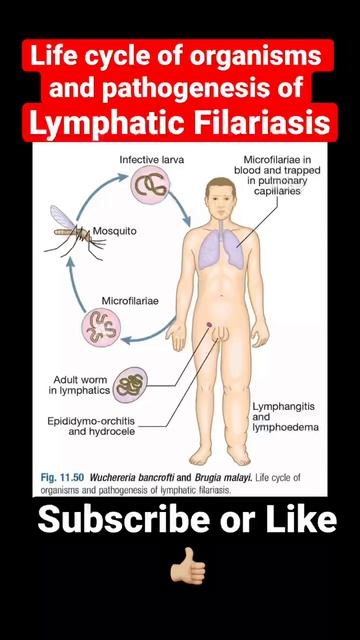 Life cycle of Organisms and pathogenesis of Lymphatic Filariasis