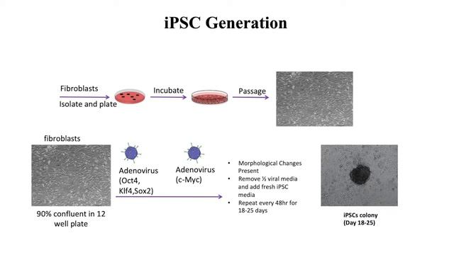 IINN Grand Rounds "Neuronal Replacement Therapy Using Induced Pluripotent Stem Cell Transplantation