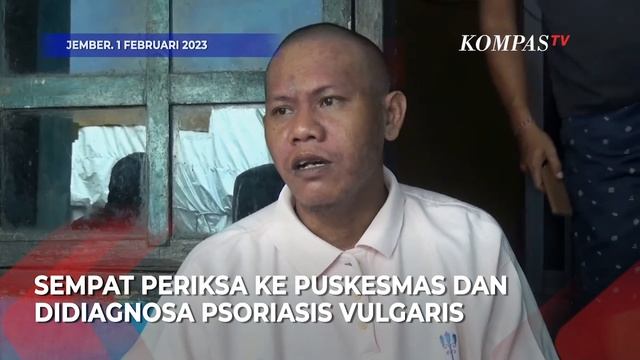 Seorang Pria di Jember Dikucilkan Tetangganya Gara-gara Penyakit yang Ia Derita