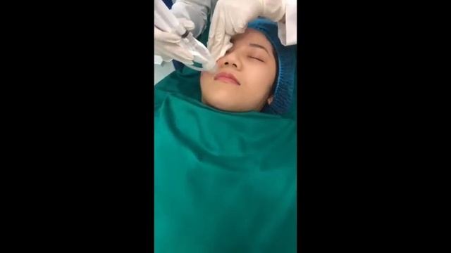 Quy trình tiêm Meso căng bóng da, dưỡng ẩm và Collagen loại III của VIP Medical