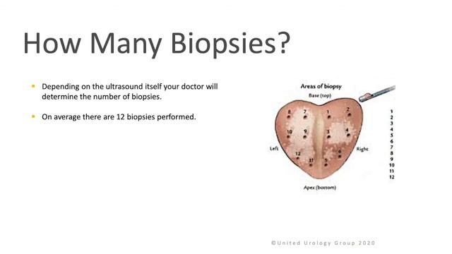 TRUS Prostate Biopsy