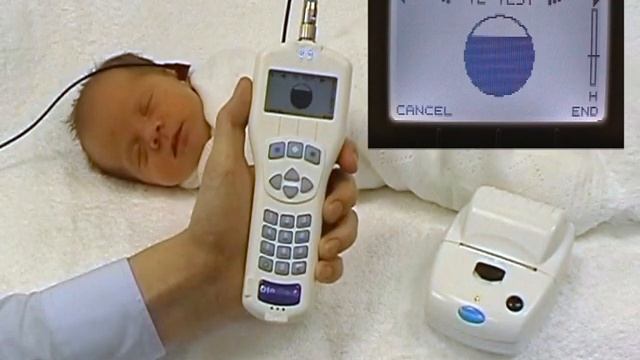 Otocheck seven second TEOAE testing