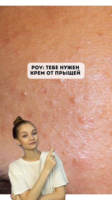 Замучили ПРЫЩИ? Попробуй Крем от прыщей, комедонов и черных точек(Арт.Wb: 154859673) #крем #прыщи