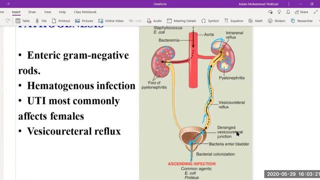 Tubulointerstitial Nephritis | YouTube Journal Club |Learning Pathology#V60