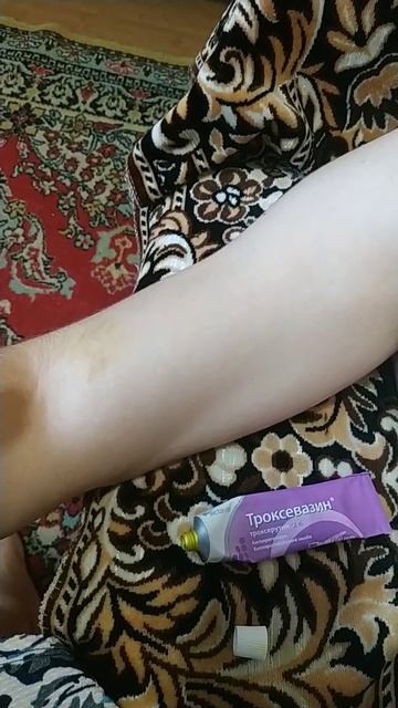 Троксевазин від синців