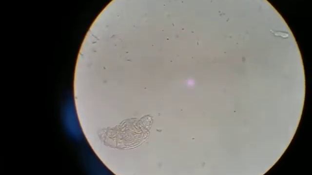 Pond Parasite_1 - 17/05/11