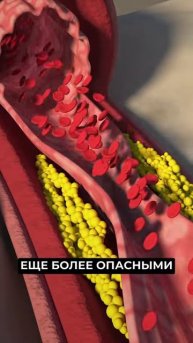 НАИБОЛЕЕ ЧАСТО ВСТРЕЧАЮЩИЕСЯ ЗАБОЛЕВАНИЯ СЕРДЦА.