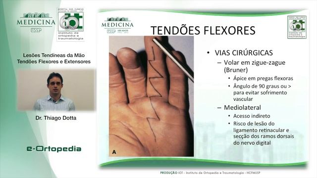 Lesões Tendíneas da Mão Tendões Flexores e Extensores - Dr. Thiago Dotta