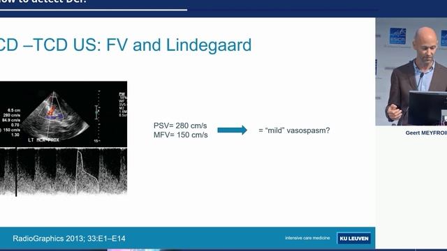 2019 How to detect DCI in SAH Geert Meyfroidt