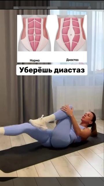 Укрепление тазового дна