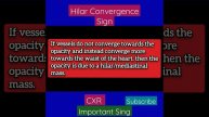 CXR - Hilar Covergence Sign - Pulmonary artery dilation Vs Hilar mass difference - Radiology Review