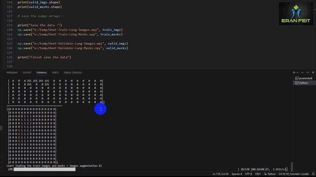 How to segment X-Ray lungs using U-Net and Tensorflow