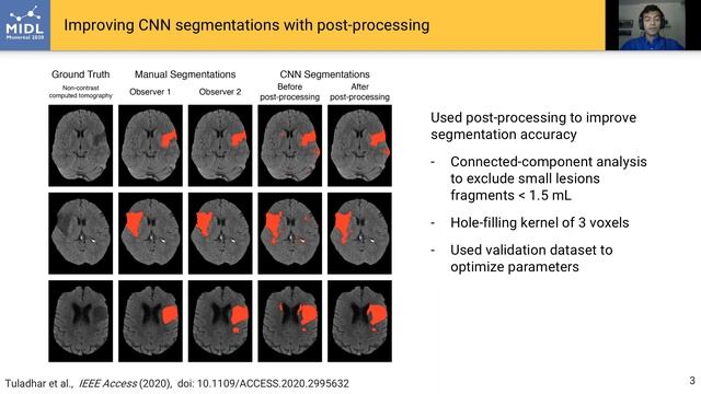 MIDL 2020, S161, Tuladhar et al. Short presentation