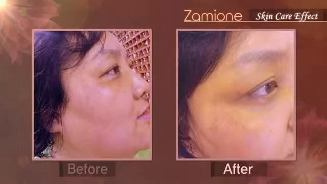 The mineral water based All-in-one Gel for daily skincare