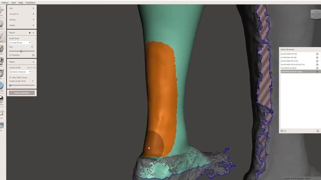 Digital Days - Learning to create 3D printed prosthetic covers