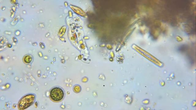 Amoeba ( species : Saccamoeba ).avi