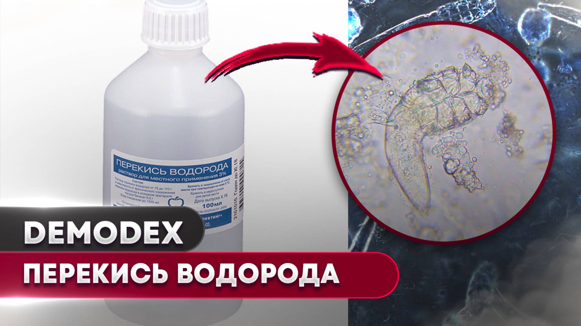 Перекись Водорода против клеща | Угревая Железница Demodex