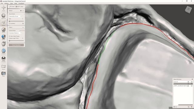 MESHMIXER DENTAL : Tutorial come creare un provvisorio temporary C&B