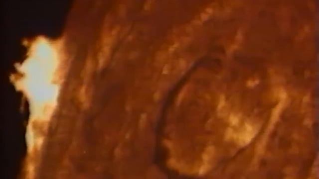 VERTEBRAL - SOLARIS