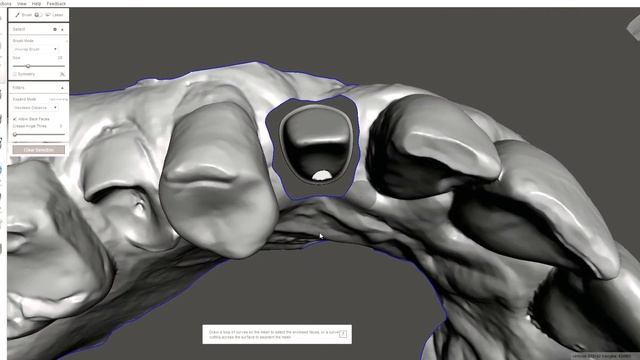 meshmixer and a abutment core file