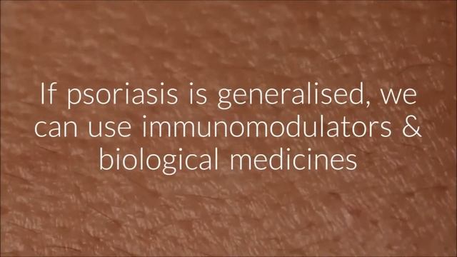 How To Treat Psoriasis Effectively | The Esthetic Clinics, India.