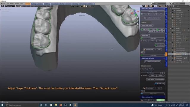 Designing a night guard in Blender.