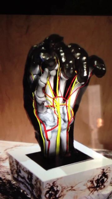 "Left Hand of Eustache de Saint-Pierre" by Rodin, with augmented reality anatomical view