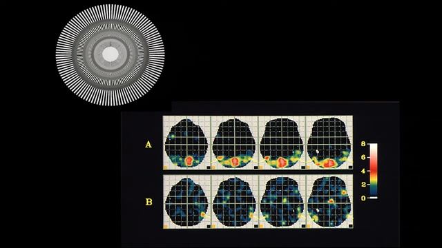 Neural Correlates of the Experience of Beauty, Including Mathematical Beauty | Professor Semir Zeki