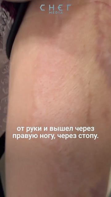 Я жива после 27000 Вольт