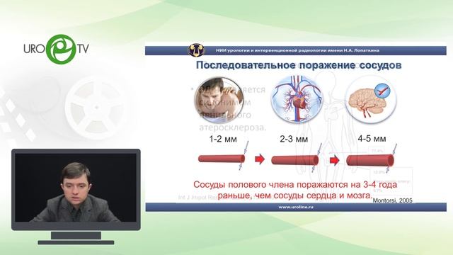 Эректильная дисфункция (ЭД). Метаболические факторы риска ЭД и борьба с ними.