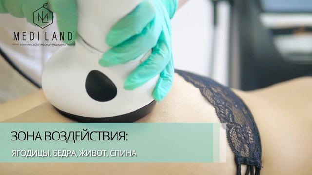 RF-лифтинг тела с вакуумным воздействием / запатентованная технология  V-Form