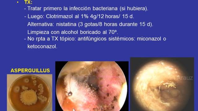 Tmmed otorrinolaringología - OTORRINOLARINGOLOGIA 1 B