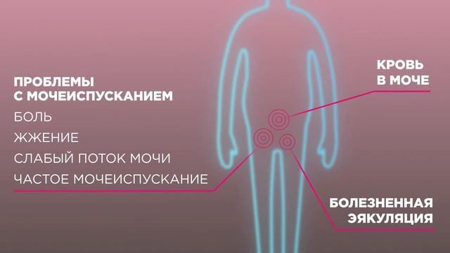 О факторах риска возникновения рака предстательной железы