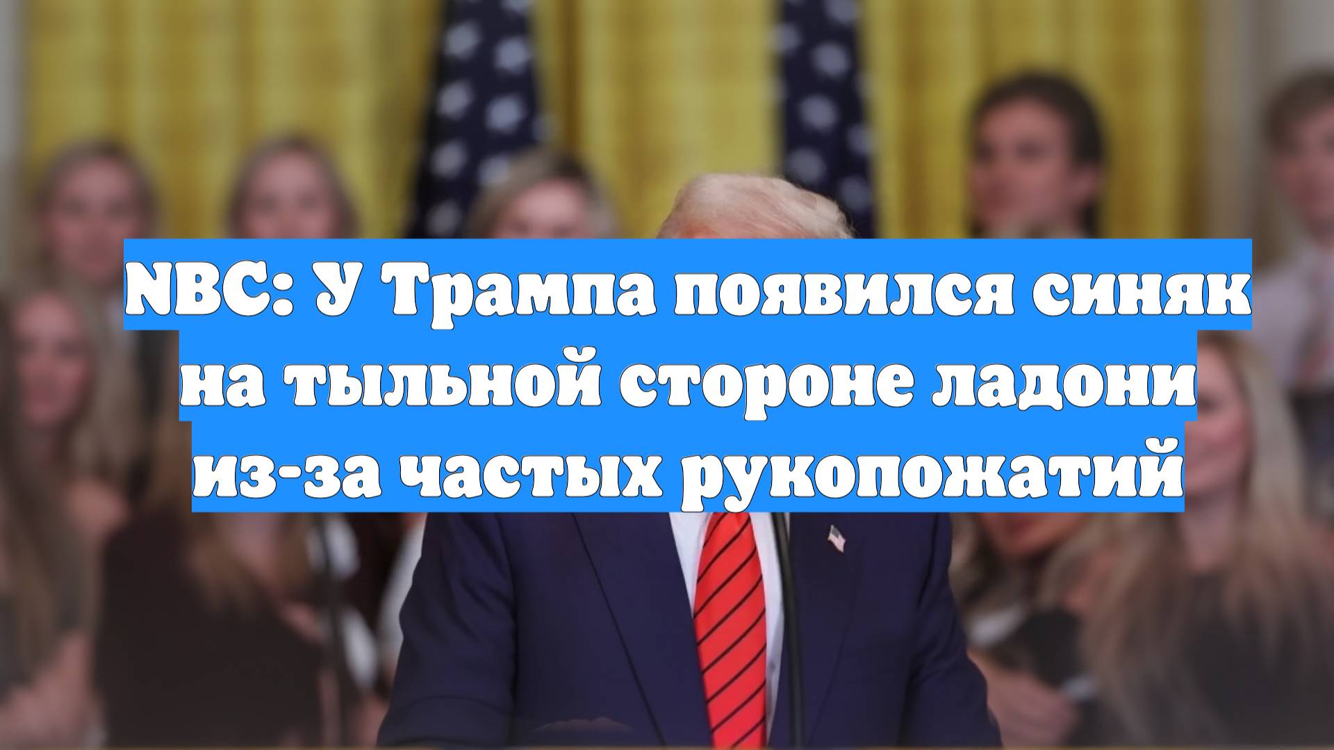 NBC: У Трампа появился синяк на тыльной стороне ладони из-за частых рукопожатий