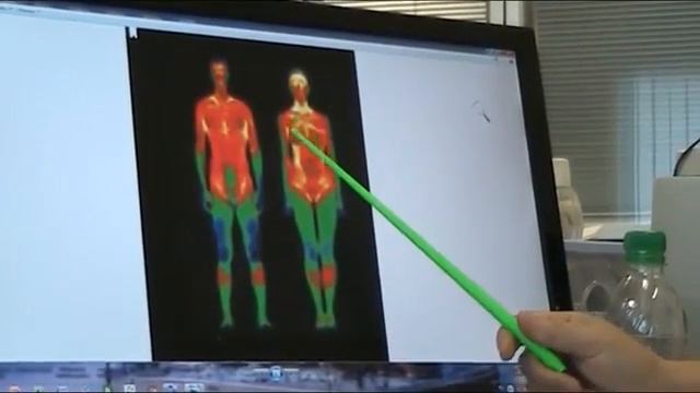 6. Основа профилактики сердечно сосудистых заб-ий. Умение перераспределять кровь по организму.
