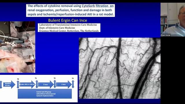 Influence of hemoadsorption on microcirculation Can Ince 2021