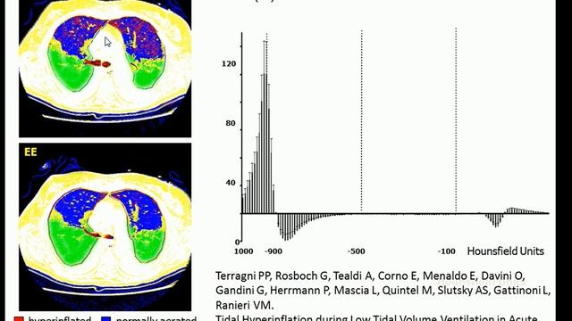 From protective to ultraprotective ventilation Michael Quintel 2014