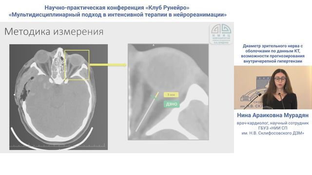 Диаметр зр нерва с оболочками по КТ и ВЧГ Мурадян К