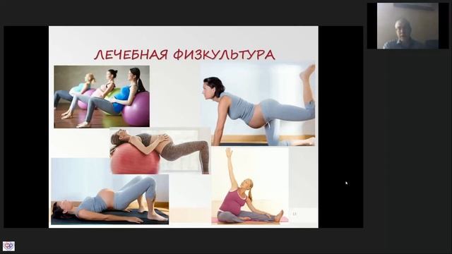 Боль в спине у беременных Карелов А.Е.